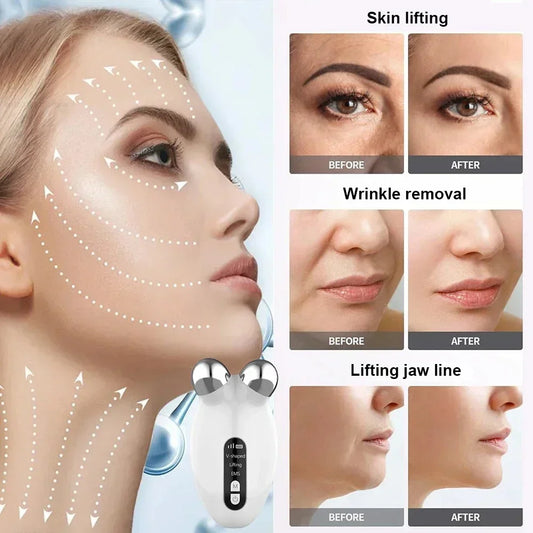 Facial Massager Microcurrent Roller EMS Device For Face Lifting Skin Tighten Rejuvenation Chin Remover Anti Wrikle Double care - Global Mix