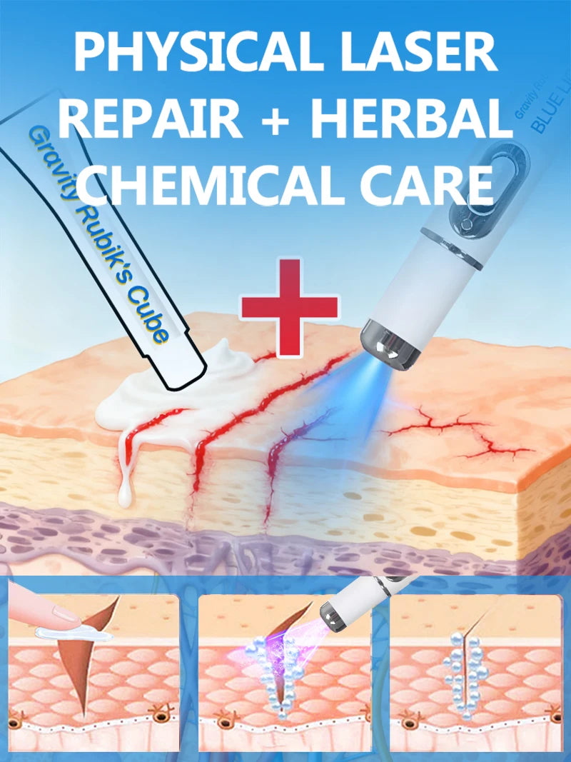 Striae blue light tool Goodbye To Stretch Marks, Maternal Skincare Tools - Global Mix