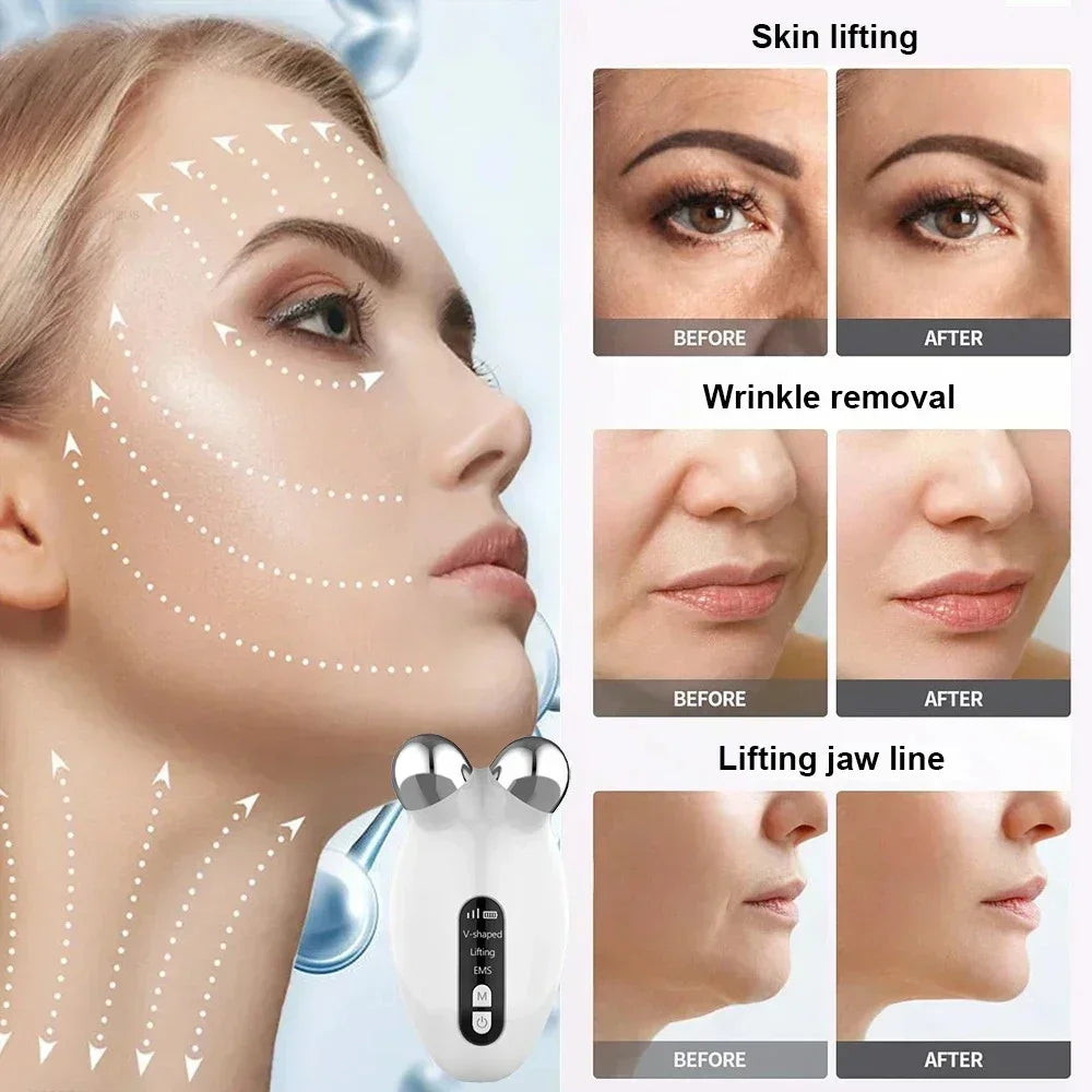 Facial Massager Microcurrent Roller EMS Device For Face Lifting Skin Tighten Rejuvenation Chin Remover Anti Wrikle Double care - Global Mix