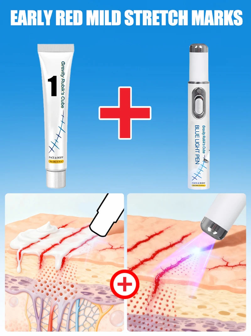 Striae blue light tool Goodbye To Stretch Marks, Maternal Skincare Tools - Global Mix
