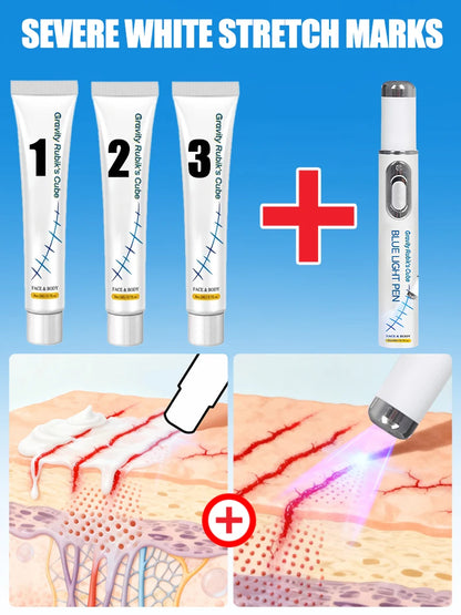 Striae blue light tool Goodbye To Stretch Marks, Maternal Skincare Tools - Global Mix